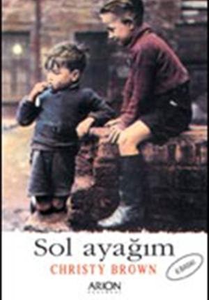 SOL AYAĞIM